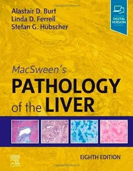 Imagem de MacSween's Pathology of the Liver