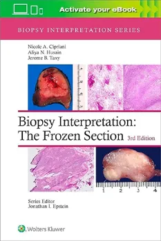 Picture of Book Biopsy Interpretation: The Frozen Section