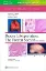 Imagem de Biopsy Interpretation: The Frozen Section