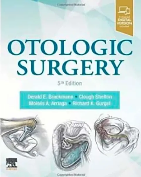 Imagem de Otologic Surgery