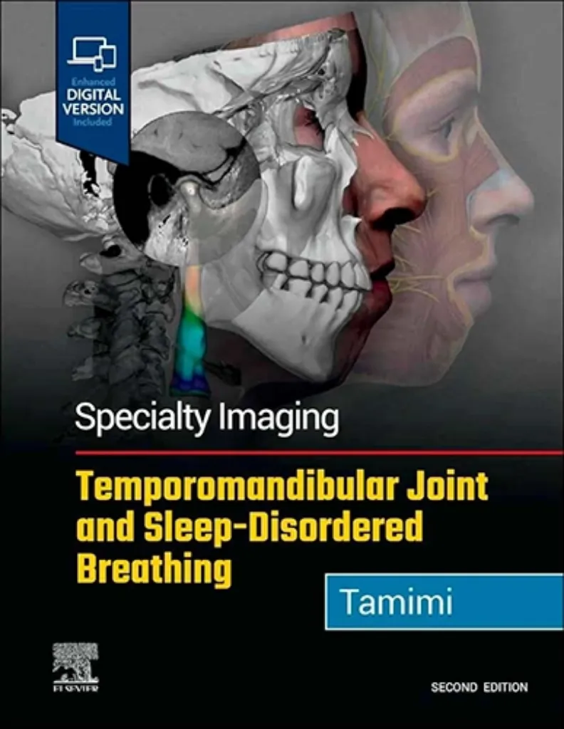 Imagem de Speciality Imaging: Temporomandibular Joint and Sleep-Disordered Breathing