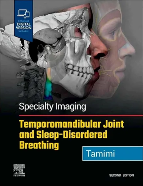Imagem de Speciality Imaging: Temporomandibular Joint and Sleep-Disordered Breathing