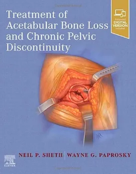 Picture of Book Treatment of Acetabular Bone Loss and Chronic Pelvic Discontinuity