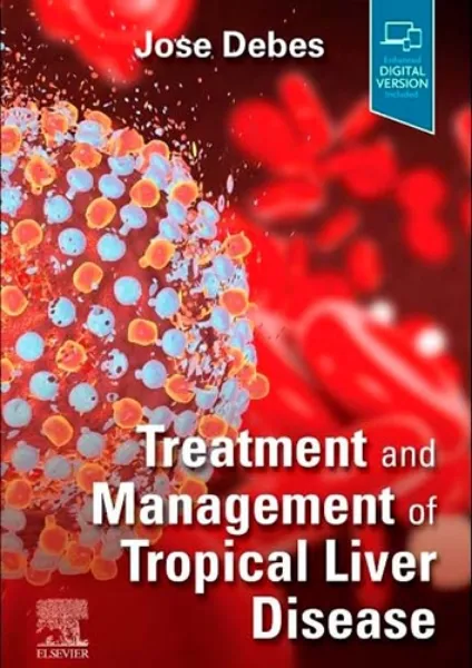 Imagem de Treatment and Management of Tropical Liver Disease