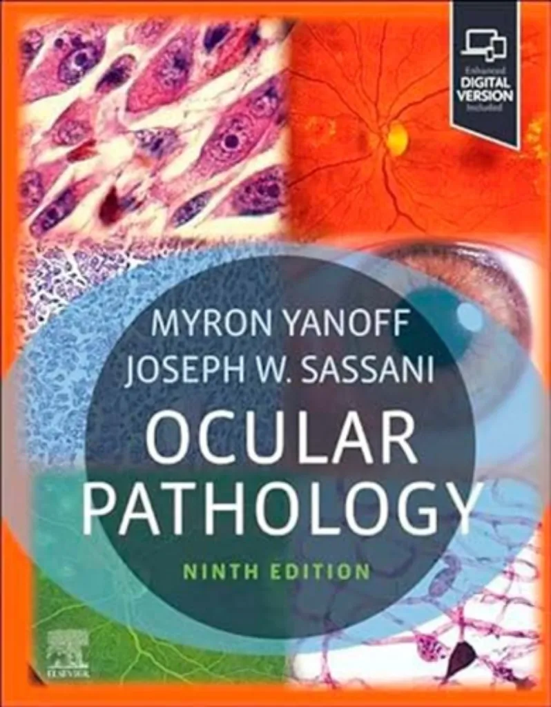 Imagem de Ocular Pathology