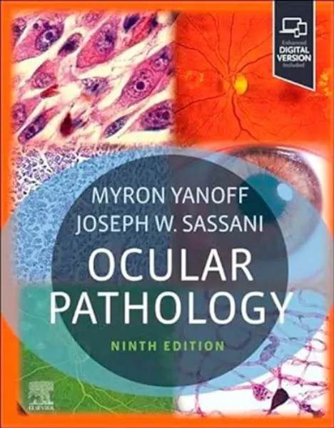 Imagem de Ocular Pathology