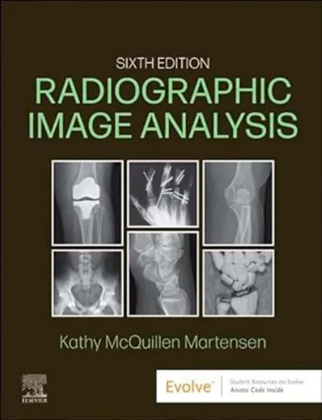 Imagem de Radiographic Image Analysis