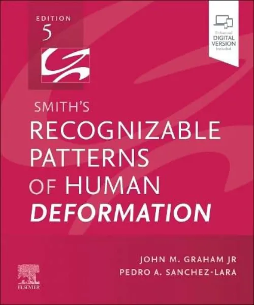 Imagem de Smith's Recognizable Patterns of Human Deformation
