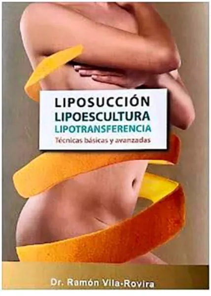 Imagem de Liposucción - Lipoescultura - Lipotransferencia : Técnicas Básicas y Avanzadas