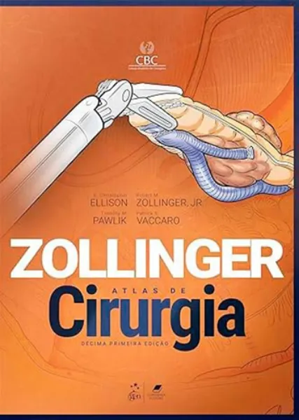 Imagem de Zollinger - Atlas de Cirurgia