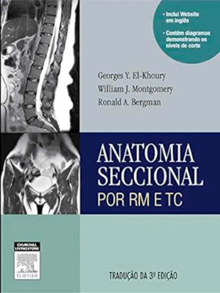 Imagem de Anatomia Seccional por RM e TC