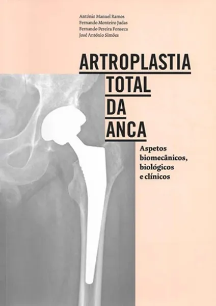 Imagem de Artroplastia Total da Anca - Aspetos Biomecânicos, Biológicos e Clínicos