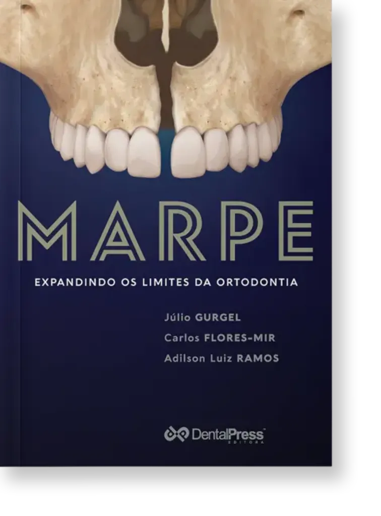Picture of Book MARPE: Expandindo os Limites da Ortodontia